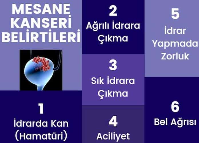 Mesane kanseri ölümcülmüdür Belirtileri ve Evreleri