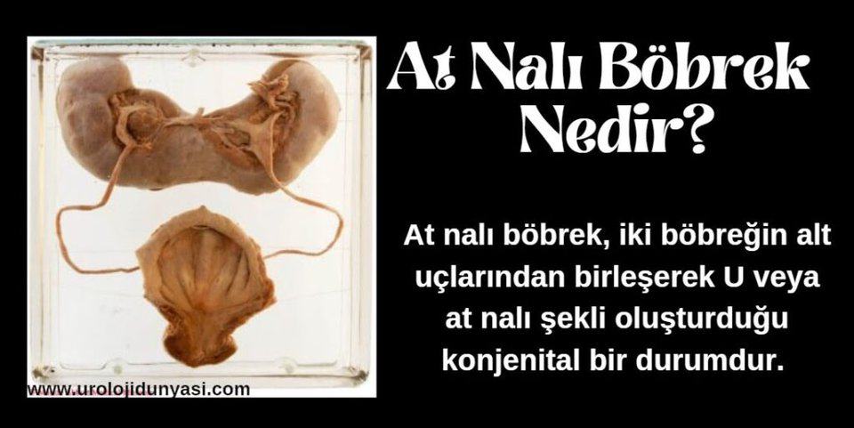 at nalı böbrek nedir