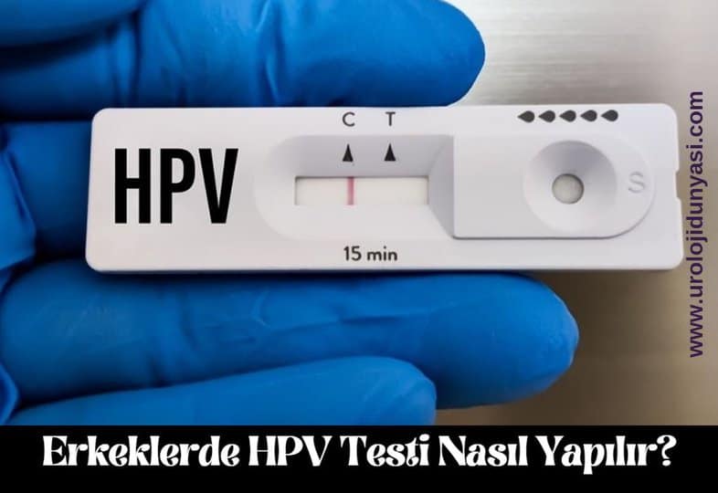 erkeklerde hpv testi nasıl yapılır