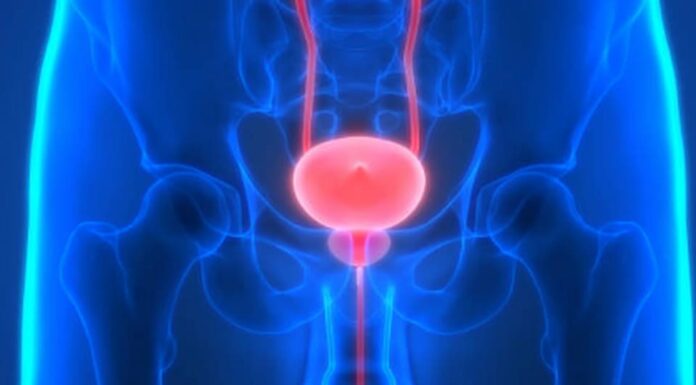 Limon prostata zararlımı? limon prostata zararlımı