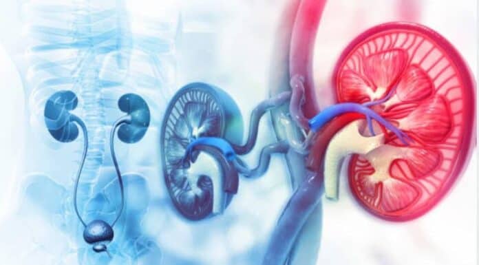 Üreterosel nedir? üreterosel